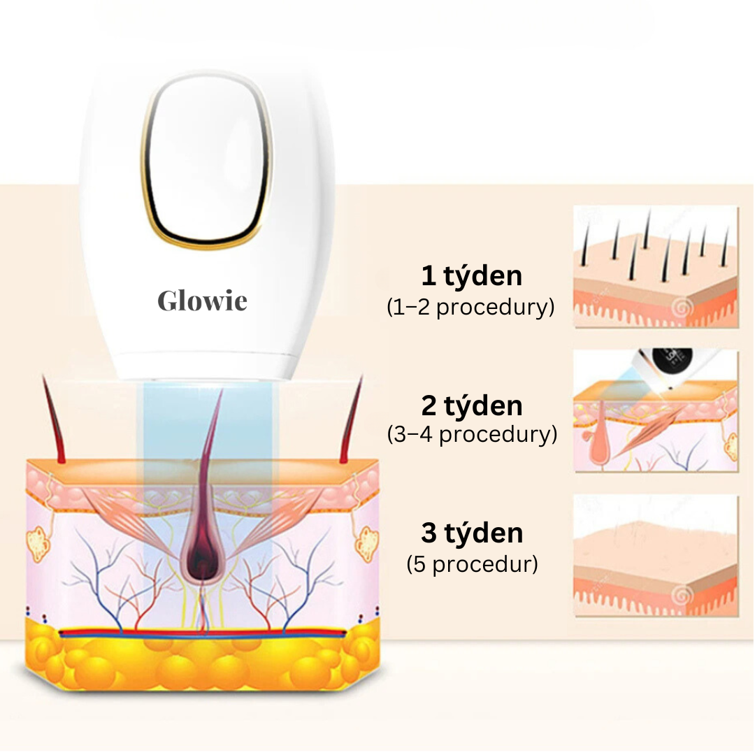 Glowie™ IPL Epilátor – Zařízení pro odstranění chloupků