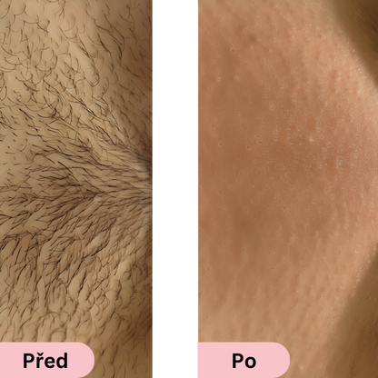 Glowie™ IPL Fotoepilátor – Přístroj na odstraňování chloupků