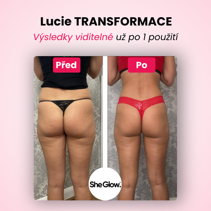 SheGlow™ PRO – sada pro odstranění celulitidy